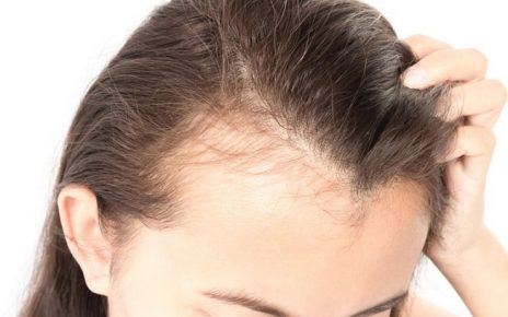 8 nguyên nhân rụng tóc phổ biến: Do căng thẳng, chăm không đúng cách