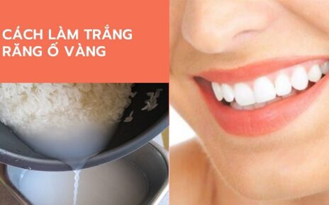 Tiết lộ cách làm trắng răng bị ố vàng cực an toàn với nước vo gạo
