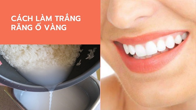Tiết lộ cách làm trắng răng bị ố vàng cực an toàn với nước vo gạo