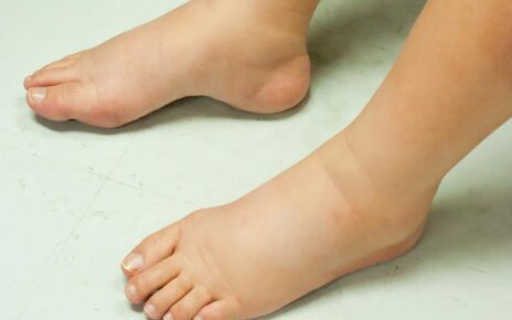 4 đặc điểm ở chân có thể là dấu hiệu bệnh ung thư nguy hiểm